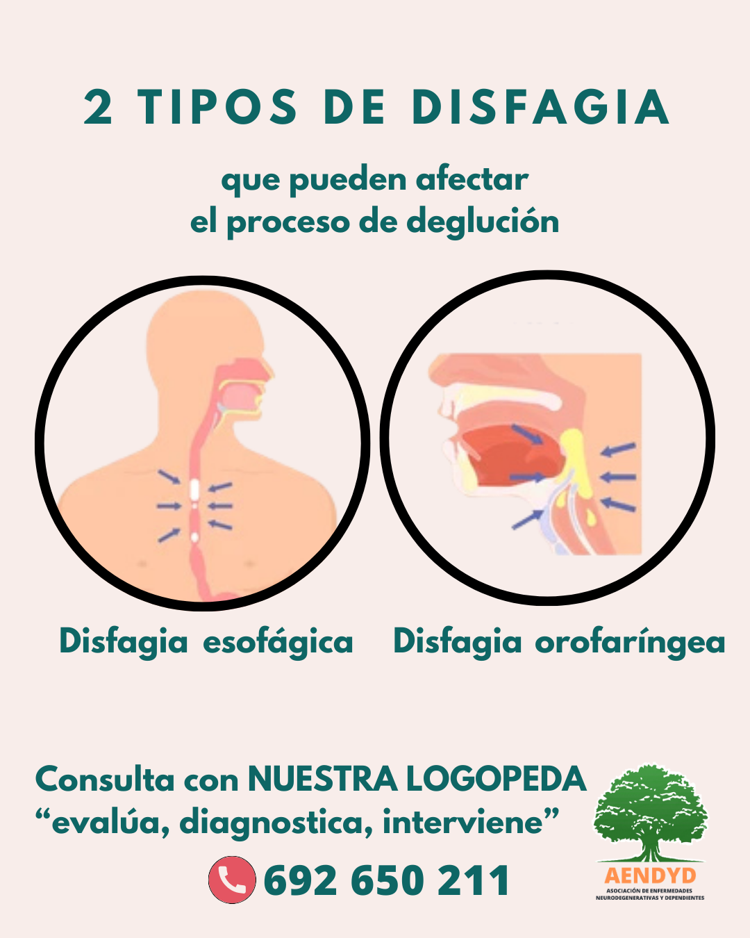 Tipos de disfagia AENDYD